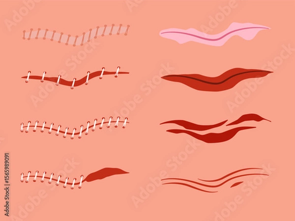 Obraz A collection of vector illustrations depicting various types of human skin wounds including scratches scrapes abrasions