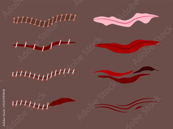 Obraz Human skin wounds including scratches scrapes abrasions vector illustrations on dark skin