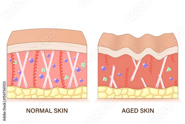 Fototapeta Structure of aged skin. Comparison of normal and aged skin. Facial skin problems. Vector for advertising about beauty and medical treatment.