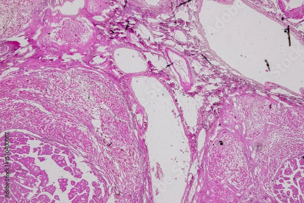 Obraz Pathology and Histology Tissue of Mammals under microscope.