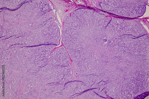 Obraz Pathology and Histology Tissue of Mammals under microscope.