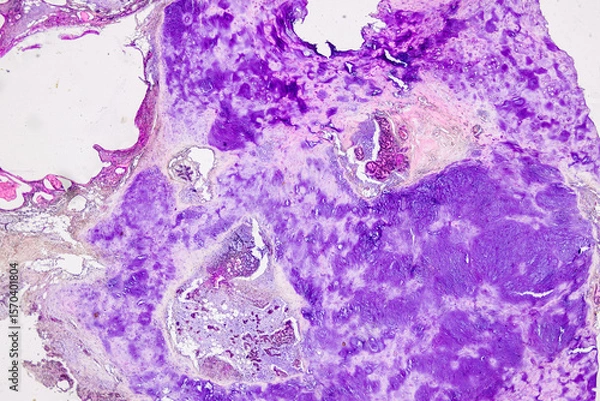 Obraz Pathology and Histology Tissue of Mammals under microscope.