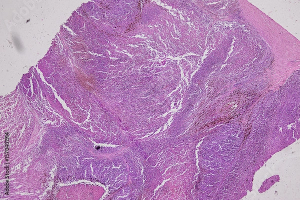 Obraz Pathology and Histology Tissue of Mammals under microscope.