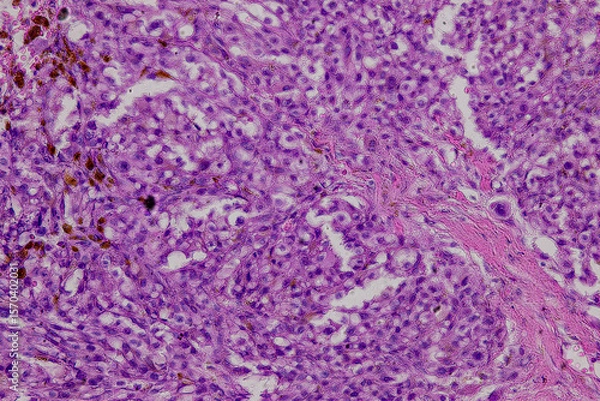Obraz Pathology and Histology Tissue of Mammals under microscope.