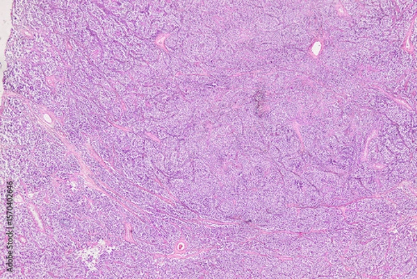 Obraz Pathology and Histology Tissue of Mammals under microscope.