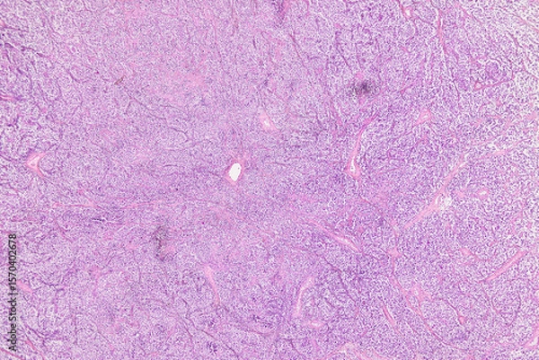 Obraz Pathology and Histology Tissue of Mammals under microscope.