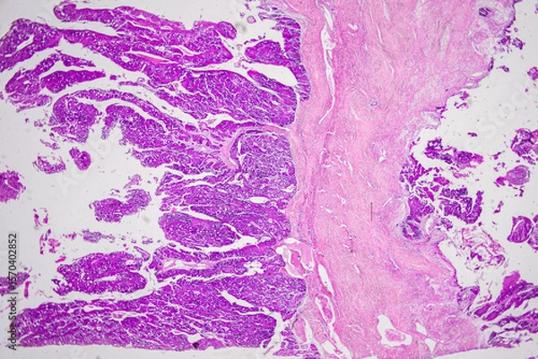 Obraz Pathology and Histology Tissue of Mammals under microscope.