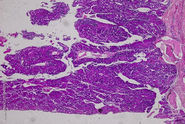 Obraz Pathology and Histology Tissue of Mammals under microscope.