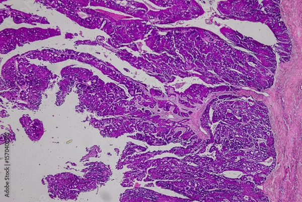 Obraz Pathology and Histology Tissue of Mammals under microscope.