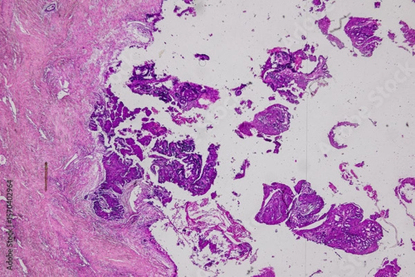 Obraz Pathology and Histology Tissue of Mammals under microscope.