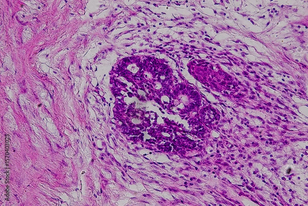 Obraz Pathology and Histology Tissue of Mammals under microscope.