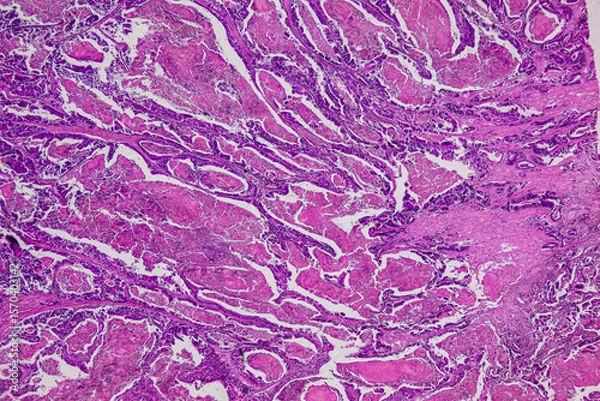 Obraz Pathology and Histology Tissue of Mammals under microscope.