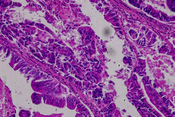 Obraz Pathology and Histology Tissue of Mammals under microscope.