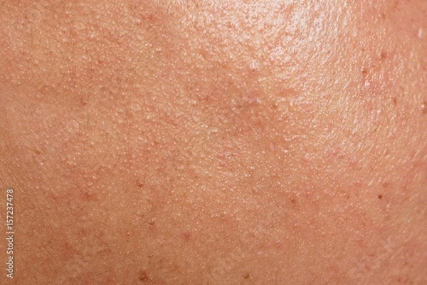 Obraz Human skin texture