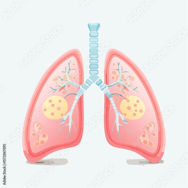 Obraz Human Lungs Anatomy: An artistic illustration of healthy lungs, showcasing their structure in vibrant detail, is a vivid representation of the respiratory system.