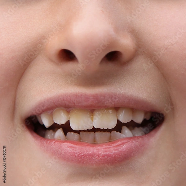 Obraz Zähne zeigen