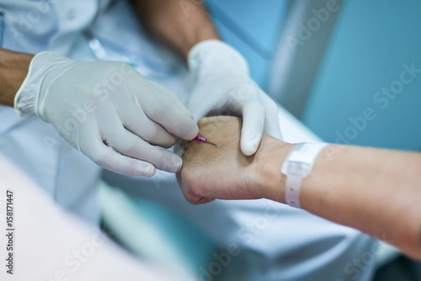 Fototapeta Pose de perfusion .