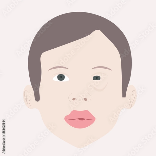 Obraz Flat vector illustrating anaphylaxis: swelling, rash, breathing trouble. Includes related allergies, asthma, and angioedema in clean, modern style. person