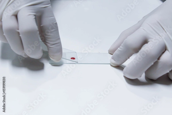 Obraz sample for blood smear method