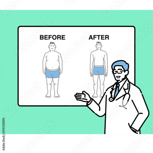 Obraz ダイエット結果を解説する医師のイラスト（ビフォーアフター図）