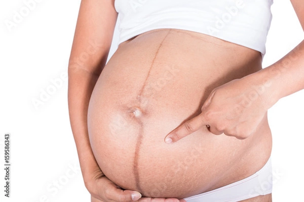 Fototapeta linea nigra and stretch marks on pregnant women