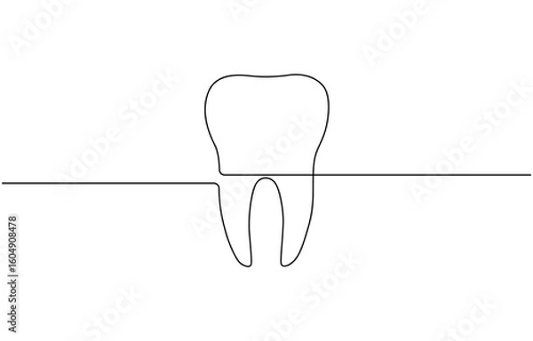 Fototapeta One Continuous Line Drawing of Tooth Whitening, Tooth continuous one line drawing. Dental symbol.