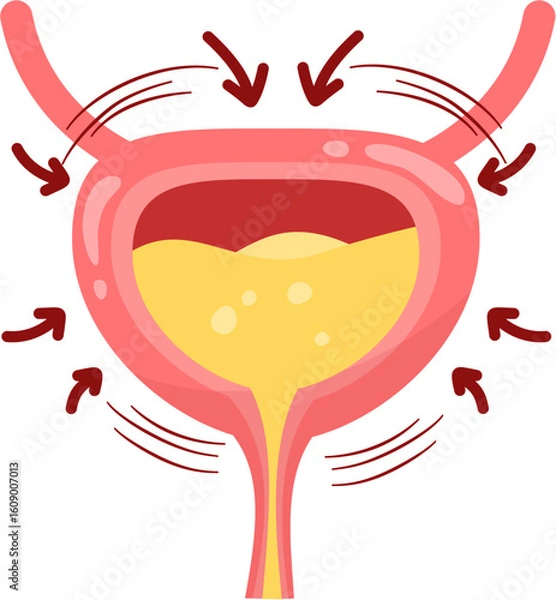 Obraz Overactive bladder