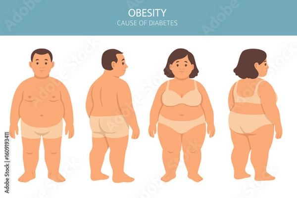 Fototapeta Flat vector illustration of an overweight man and woman shown from front and back views. Medical and health infographic about obesity and diabetes risks