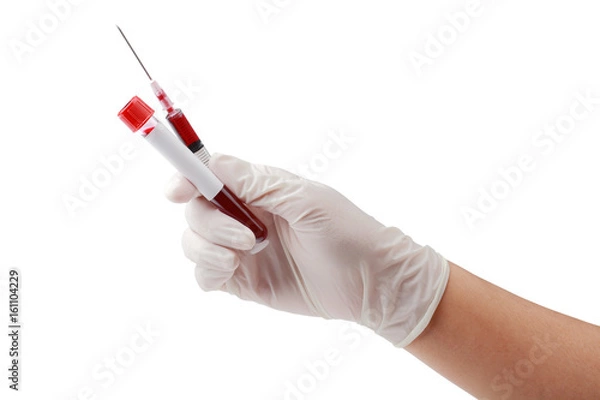 Obraz Hand holding test tube with blood plasma and a syringe for testing with clipping path.