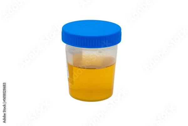Obraz Urine sample