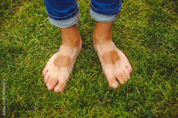 Fototapeta Legs of a man with an uneven tan