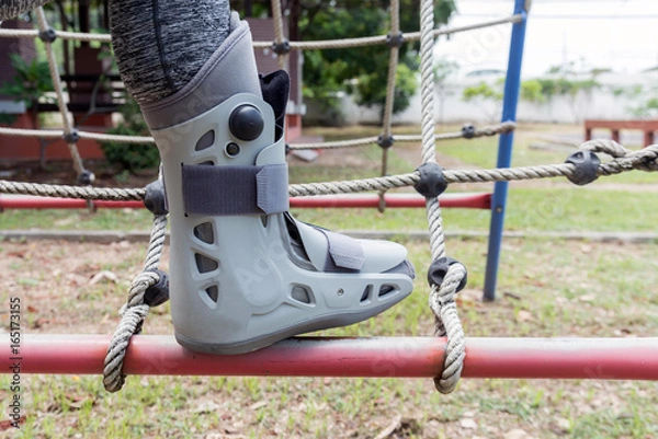 Fototapeta Broken leg the splint for treatment of injured woman on play ground background