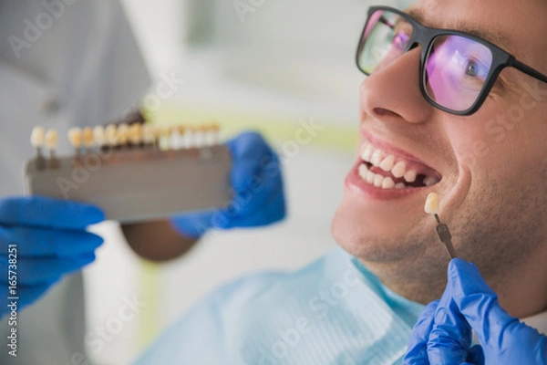 Fototapeta man smile with healthy teeth whitening. Dental care concept. Set of implants with various shades of tone