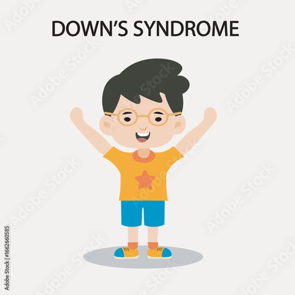 Obraz Vector illustration showing Down’s syndrome features such as low muscle tone and facial traits, highlighting key symptoms and similar conditions like Edwards and Patau syndromes.boy