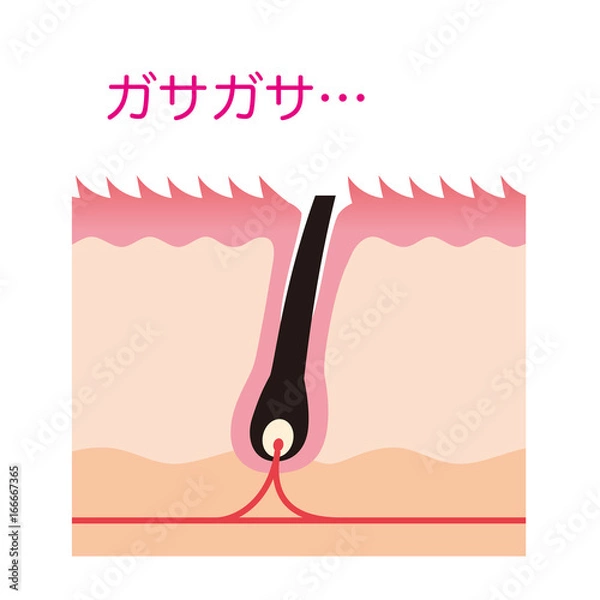 Fototapeta ムダ毛処理　カミソリ　毛の断面図