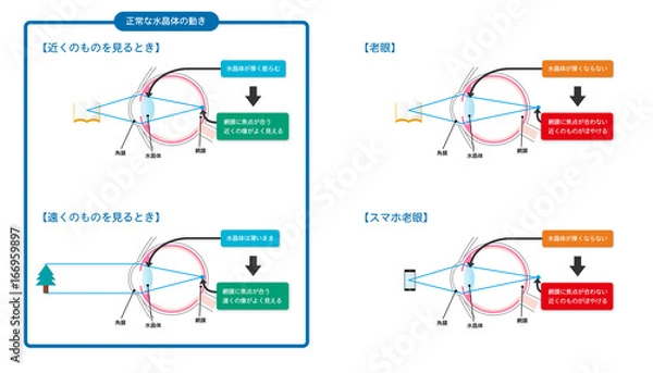 Obraz 老眼・スマホ老眼の図解ベクターイラスト