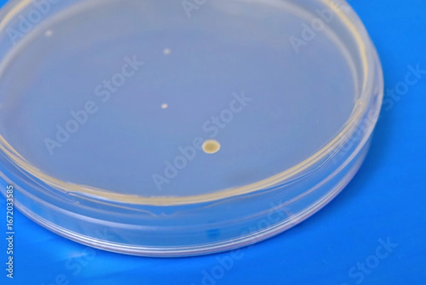 Obraz Colonies of bacteria growth on agar plate medium in laboratory.