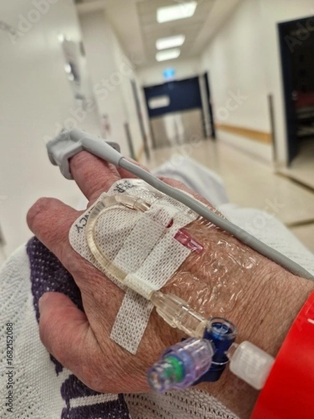 Fototapeta Cannula in hand 