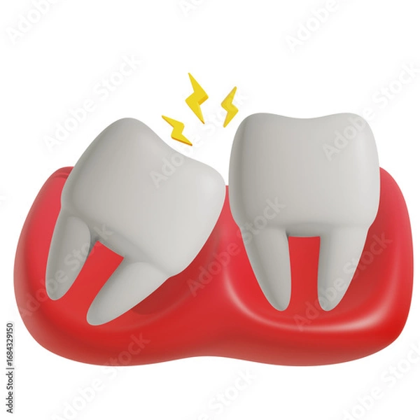 Obraz 3D Impacted Tooth