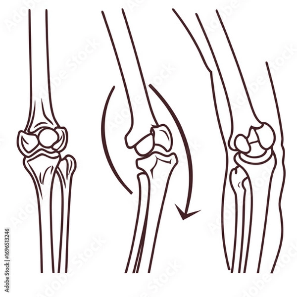 Fototapeta Outline vector icons of human joints knee elbow and shoulder