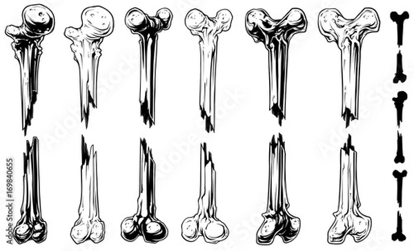 Obraz Graphic black and white broken bones vector set