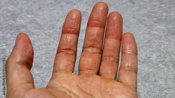 Obraz カサカサの手のクローズアップ