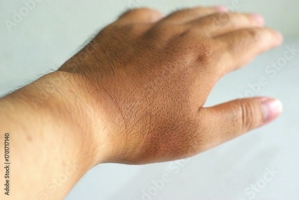 Fototapeta Close up of human hand showing visible tan line on wrist after sun exposure or wearing a watch