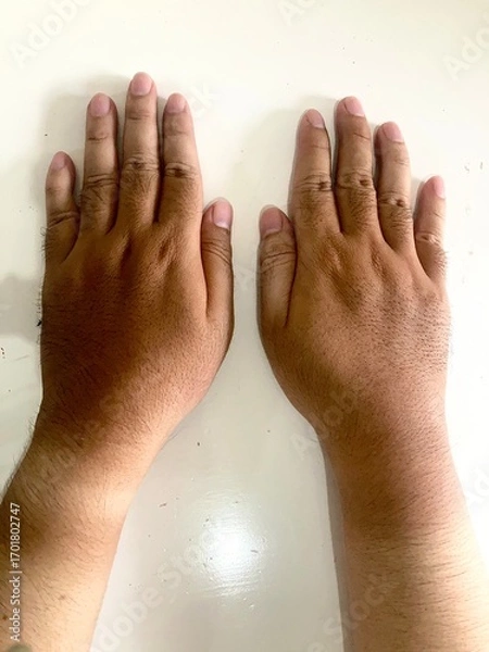 Fototapeta Human hands showing tan lines on wrists caused by sun exposure