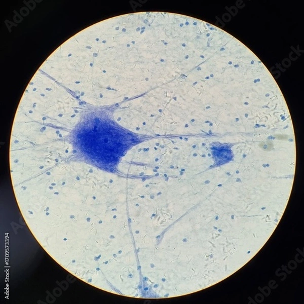 Fototapeta Microscopic image of human nerve cells showing neuron bodies and dendrites stained blue for structural visibility in a lab slide.
