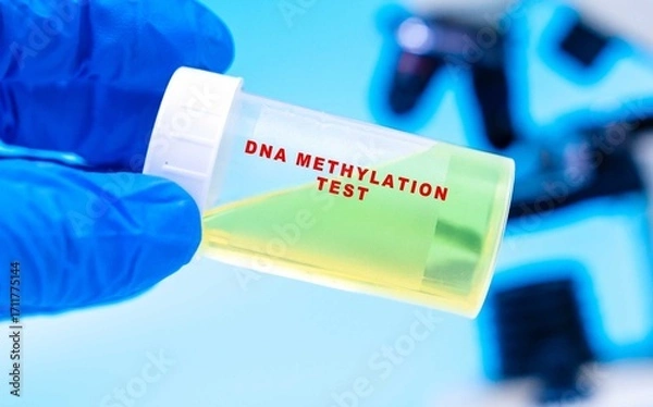 Fototapeta Analyzes epigenetic changes in DNA found in urine to