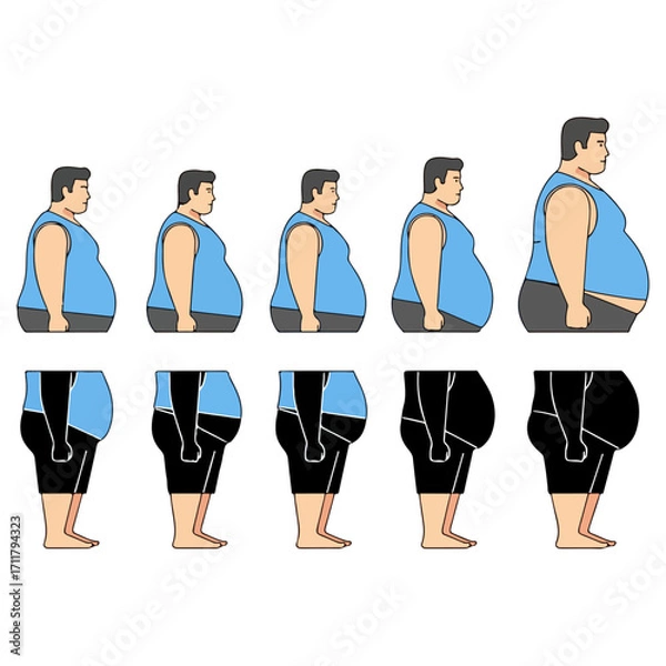 Fototapeta Progression of Weight Gain - A Visual Depiction of Obesity.