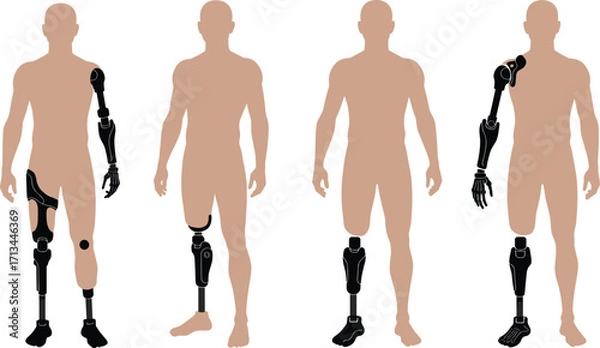 Fototapeta Vector illustration of diverse human figures with various prosthetic limbs, highlighting modern artificial limb technology, rehabilitation, mobility, and accessibility concepts