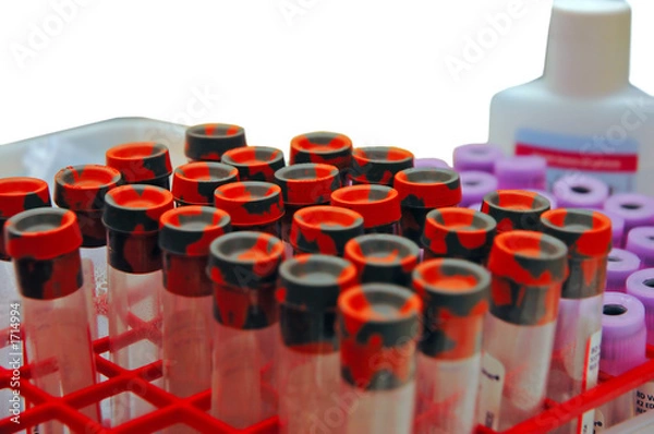 Obraz blood tests