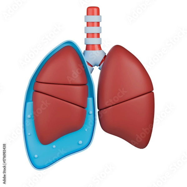 Fototapeta Transudative pleural effusion 3d illustration. Human lung with fluid accumulation in pleural space.